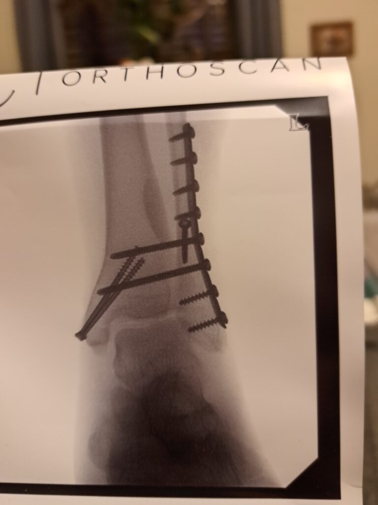 Yep, it hurt.